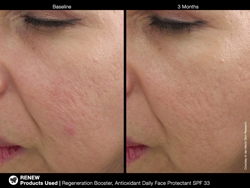 picregenerationbooster2