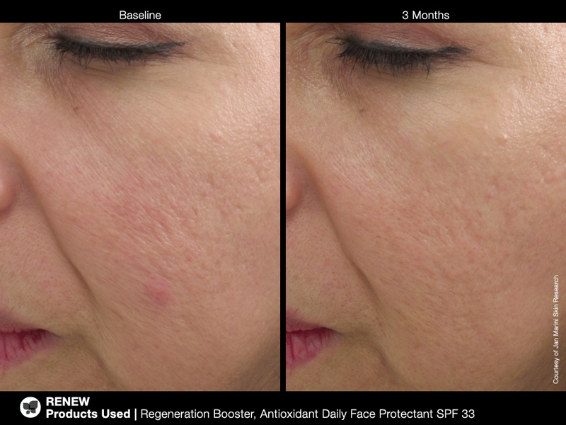 picregenerationbooster2