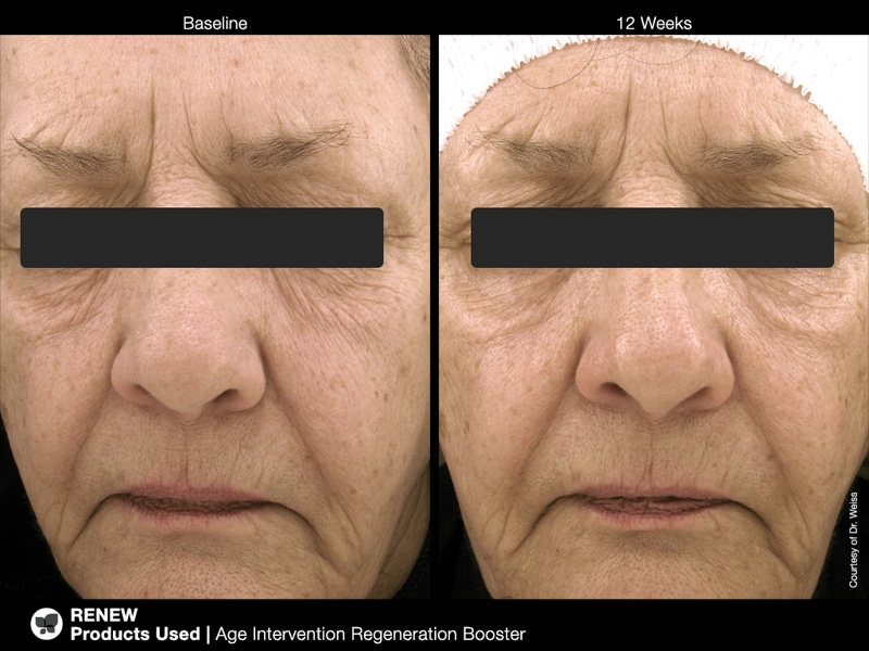 picregenrationbooster4